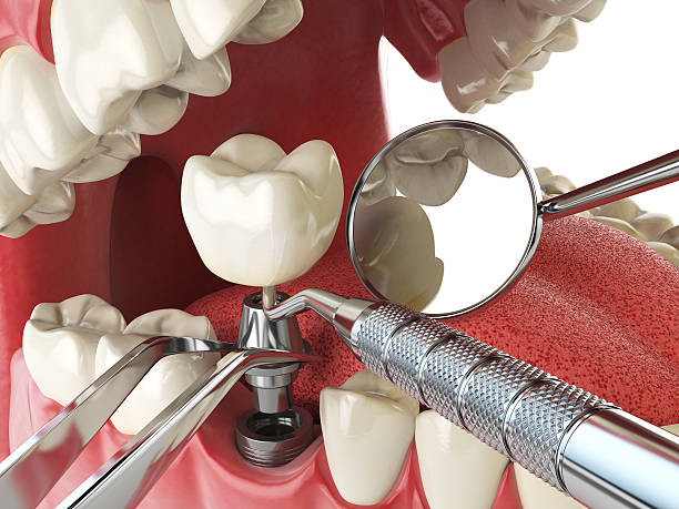 Best Dental Abscess Treatment in North Middletown, NJ